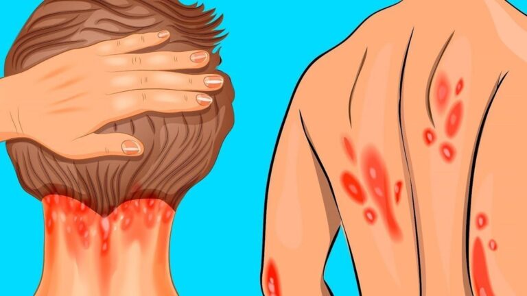 Questo trucco semplice ti farà scoprire i segni di carenza di vitamina D…