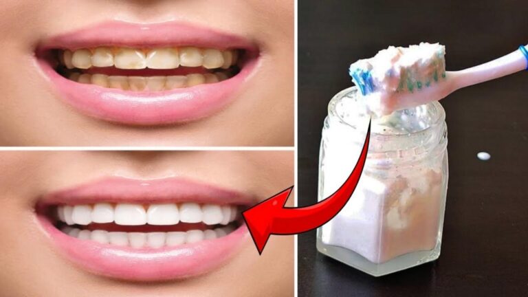 Questo trucco dimenticato rende i tuoi denti bianchi in un attimo…
