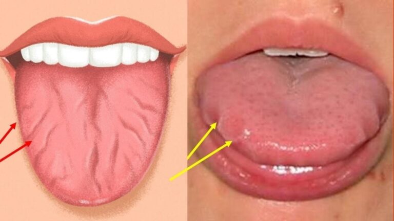 Questo semplice gesto rivela cosa significano le crepe sulla tua lingua…