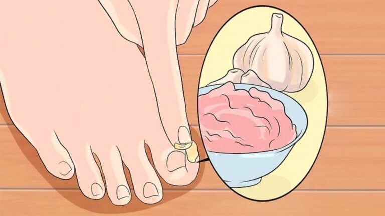 Questo trucco sorprendente con l’aglio trasformerà i tuoi piedi…