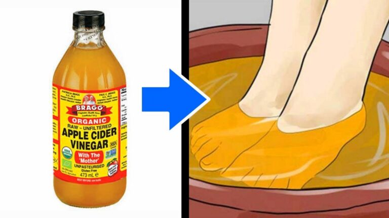 Questo semplice gesto con l’aceto di mele trasforma i tuoi piedi… scoprilo subito!