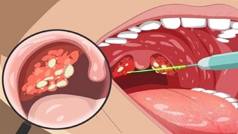 Un vecchio trucco per riconoscere malanni in tempo… non ignorarlo mai!