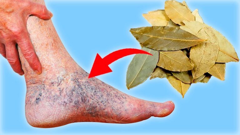 Scopri come combattere le varici con questi 3 alimenti comuni…